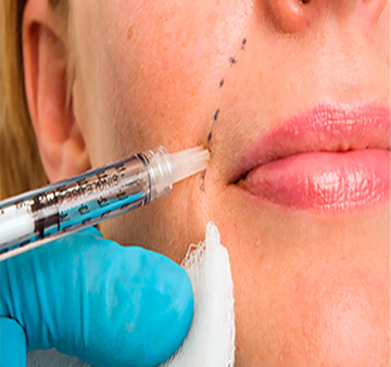 Derma Filler Photo