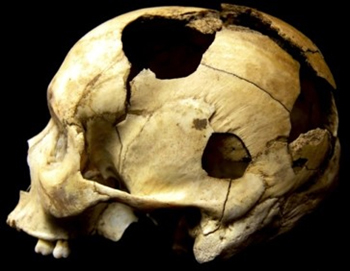 Picture of a Skull 