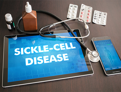 Sickle Cell Disease Research